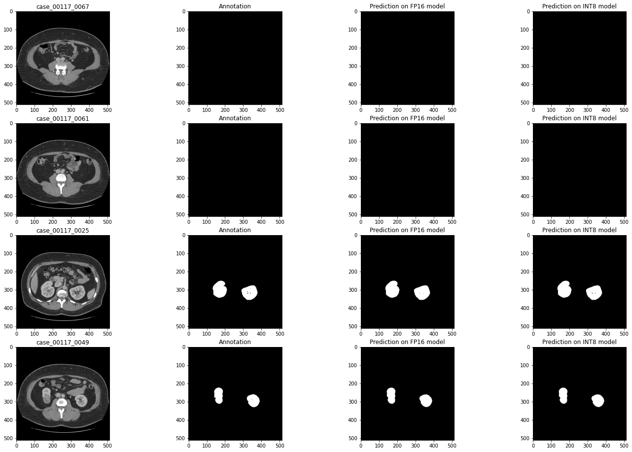 ../_images/110-ct-segmentation-quantize-with-output_29_1.png